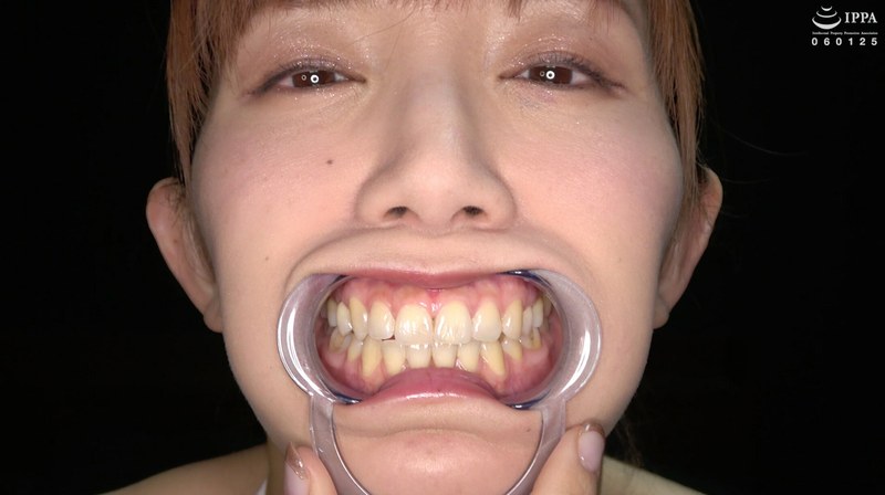 [Teeth And Oral Fetishes] Observe Either Of The Teeth, Inside The Mouth, Or Where There Are Super Rare Treatment Marks Of A Beautiful Older Sister! Miizumi Saki