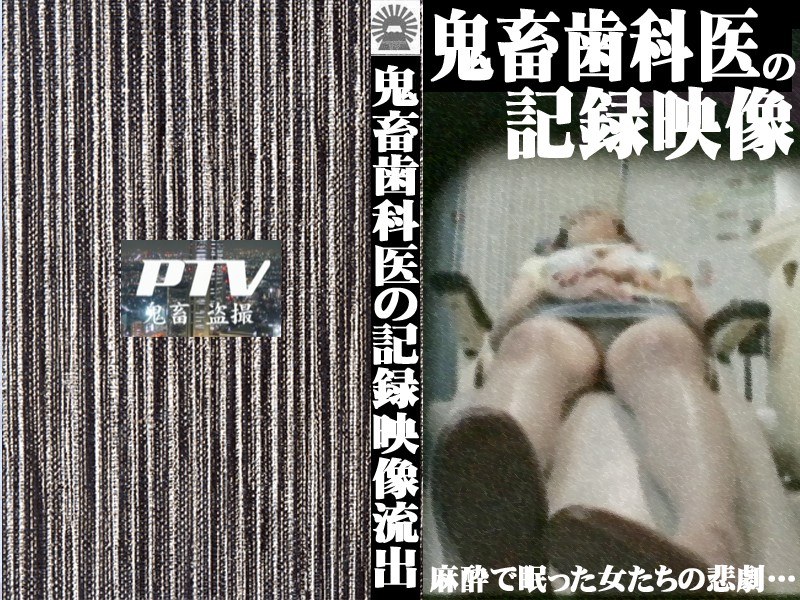 巨乳患者を狙う！鬼畜歯科医の盗撮記録